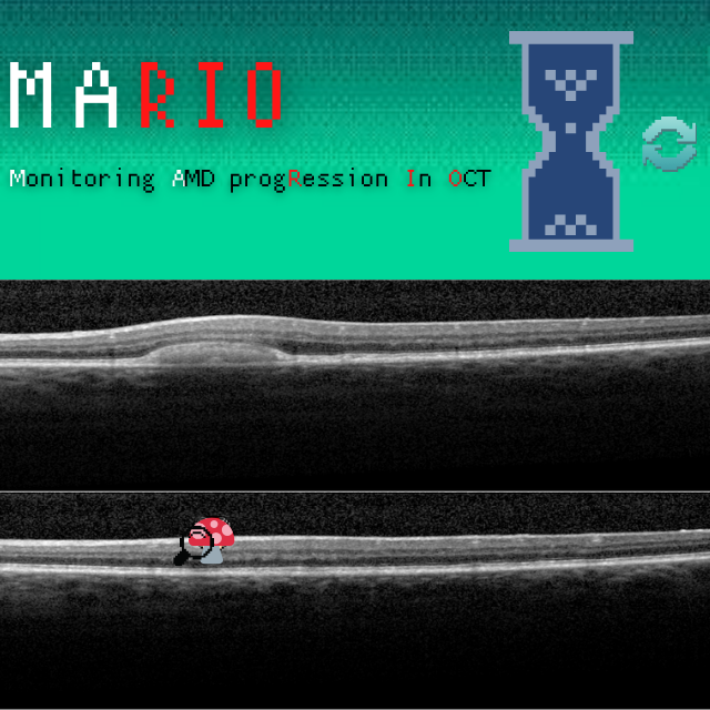 Deep Learning for Retinal Degeneration Assessment: The MARIO AMD Progression Challenge